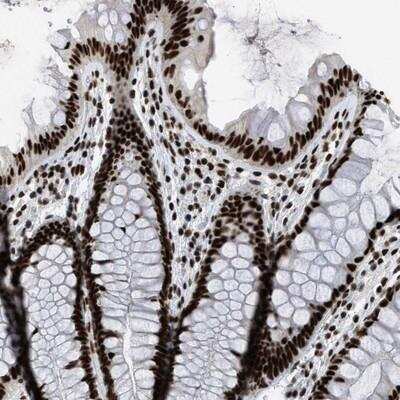 Immunohistochemistry-Paraffin: SFRS15 Antibody [NBP1-88002]