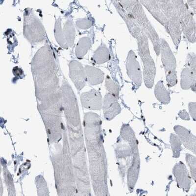 Immunohistochemistry-Paraffin: SFRS15 Antibody [NBP1-88002]