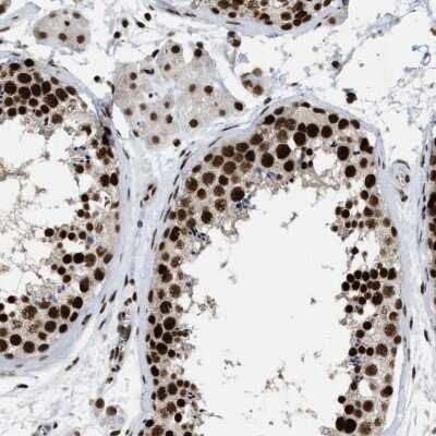Immunohistochemistry-Paraffin: SFRS15 Antibody [NBP1-88002]