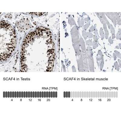 Immunohistochemistry-Paraffin: SFRS15 Antibody [NBP1-88002]