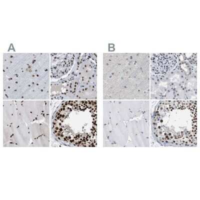 Immunohistochemistry-Paraffin: SFRS15 Antibody [NBP1-88002]