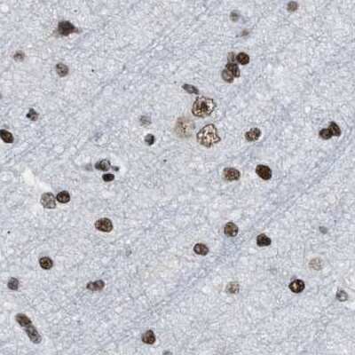 Immunohistochemistry-Paraffin: SFRS15 Antibody [NBP1-88002]
