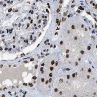Immunohistochemistry-Paraffin: SFRS15 Antibody [NBP1-88002]