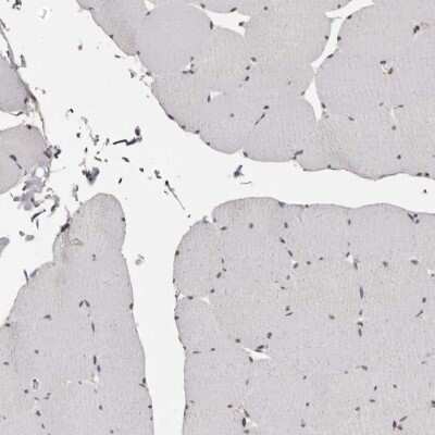 Immunohistochemistry-Paraffin: SFRS15 Antibody [NBP1-88003]