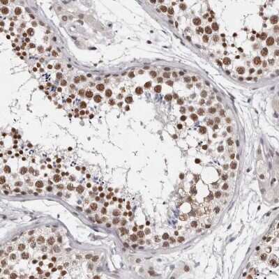 Immunohistochemistry-Paraffin: SFRS15 Antibody [NBP1-88003]