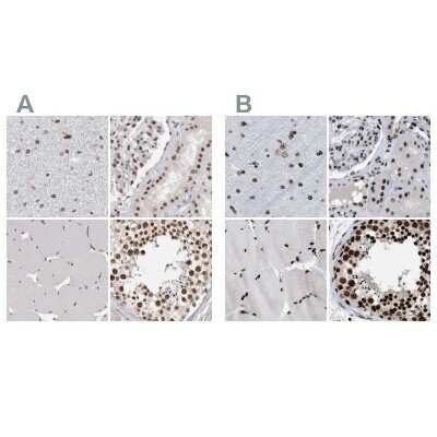Immunohistochemistry-Paraffin: SFRS15 Antibody [NBP1-88003]