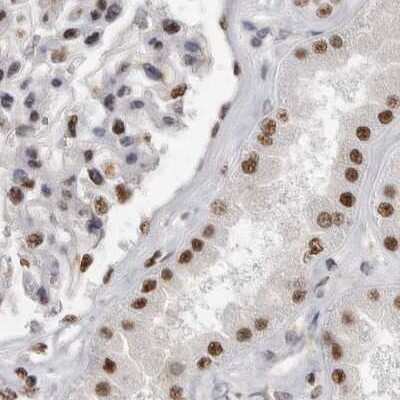 Immunohistochemistry-Paraffin: SFRS15 Antibody [NBP1-88003]