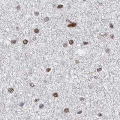 Immunohistochemistry-Paraffin: SFRS15 Antibody [NBP1-88003]