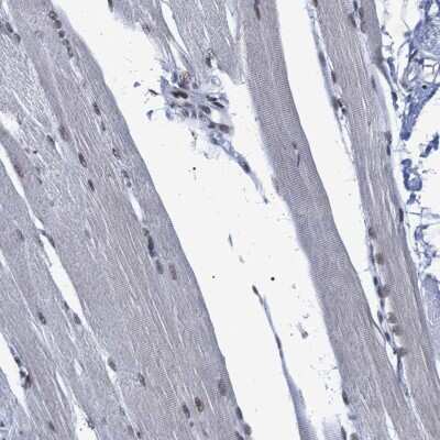 Immunohistochemistry-Paraffin: SFRS15 Antibody [NBP1-88004]