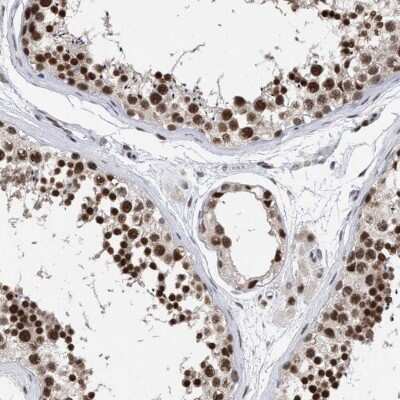 Immunohistochemistry-Paraffin: SFRS15 Antibody [NBP1-88004]