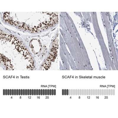 Immunohistochemistry-Paraffin: SFRS15 Antibody [NBP1-88004]