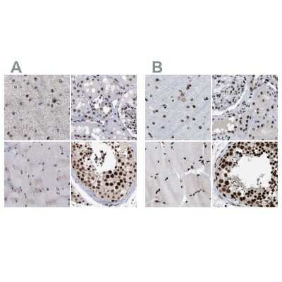 Immunohistochemistry-Paraffin: SFRS15 Antibody [NBP1-88004]