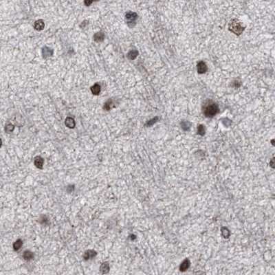 Immunohistochemistry-Paraffin: SFRS15 Antibody [NBP1-88004]