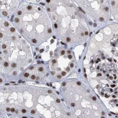 Immunohistochemistry-Paraffin: SFRS15 Antibody [NBP1-88004]