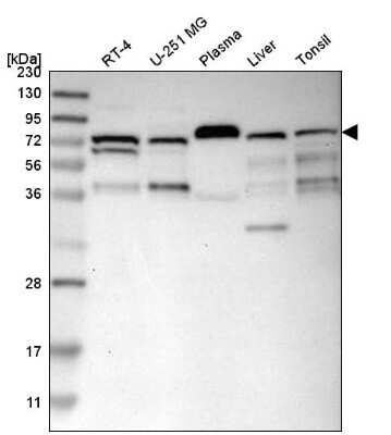 Western Blot: SFRS15 Antibody [NBP1-88002]