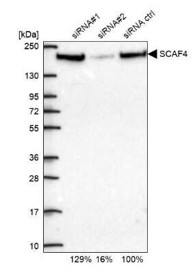 Western Blot: SFRS15 Antibody [NBP1-88002]