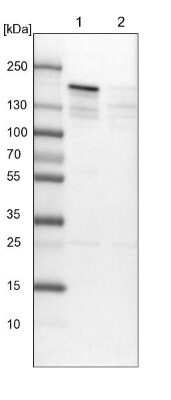 Western Blot: SFRS15 Antibody [NBP1-88003]