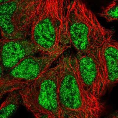 Immunocytochemistry/ Immunofluorescence: SFRS18 Antibody [NBP1-88723]