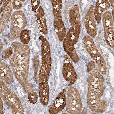 Immunohistochemistry-Paraffin: SFRS18 Antibody [NBP1-88723]