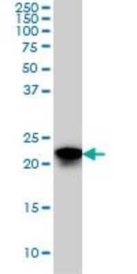 Western Blot: SFRS3 Antibody (2D2) [H00006428-M08]