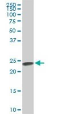 Western Blot: SFRS3 Antibody (2D2) [H00006428-M08]