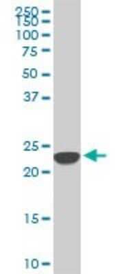 Western Blot: SFRS3 Antibody (2D2) [H00006428-M08]