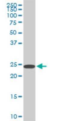 Western Blot: SFRS3 Antibody (2D2) [H00006428-M08]