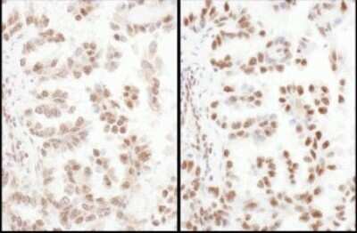 Immunohistochemistry: SFRS4 Antibody [NBP2-04143]