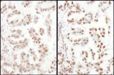 Immunohistochemistry-Paraffin: SFRS4 Antibody [NBP2-04144]