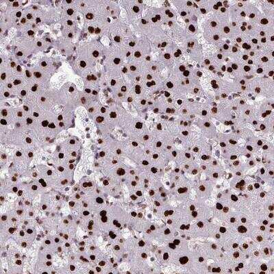 Immunohistochemistry-Paraffin: SFRS4 Antibody [NBP2-13384]