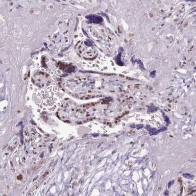 Immunohistochemistry-Paraffin: SFRS4 Antibody [NBP2-13384]
