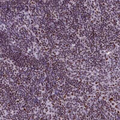 Immunohistochemistry-Paraffin: SFRS4 Antibody [NBP2-13384]