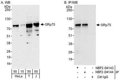 Immunoprecipitation: SFRS4 Antibody [NBP2-04143]