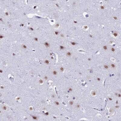 Immunohistochemistry-Paraffin: SFRS5 Antibody [NBP1-92381]