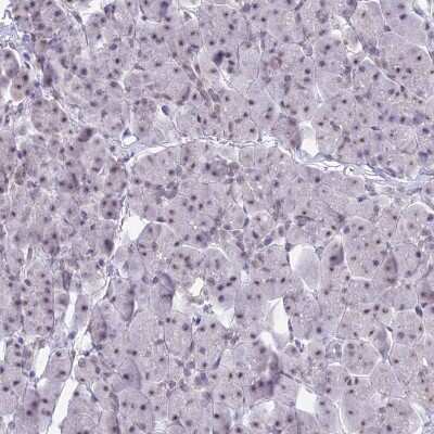Immunohistochemistry-Paraffin: SFRS5 Antibody [NBP1-92381]