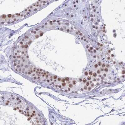 Immunohistochemistry-Paraffin: SFRS5 Antibody [NBP1-92381]