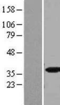 Western Blot: SFRS5 Overexpression Lysate [NBL1-15891]