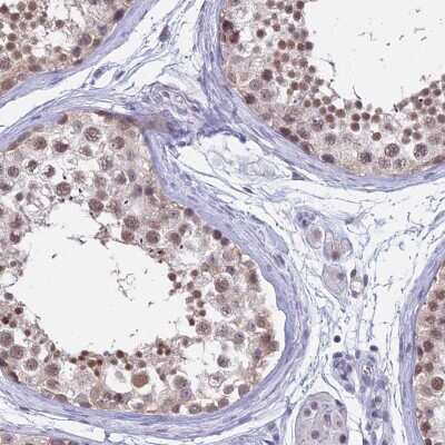 Immunohistochemistry-Paraffin: SFRS7 Antibody [NBP1-92382]