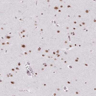 Immunohistochemistry-Paraffin: SFRS7 Antibody [NBP2-49238]