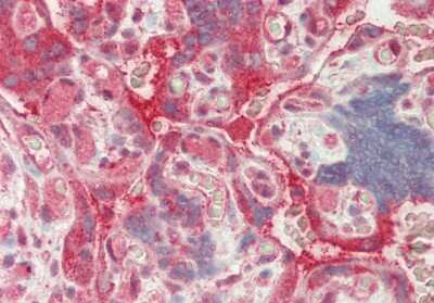 Immunohistochemistry-Paraffin: SFRS7 Antibody [NBP2-88251]