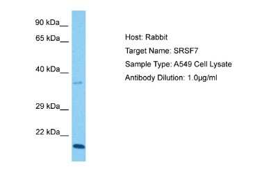 Western Blot: SFRS7 Antibody [NBP2-88251]