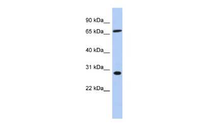 Western Blot: SFRS7 Antibody [NBP2-88252]