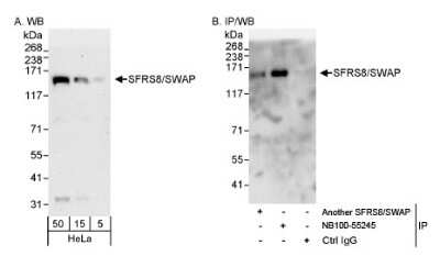 Western Blot: SFRS8 Antibody [NB100-55245]