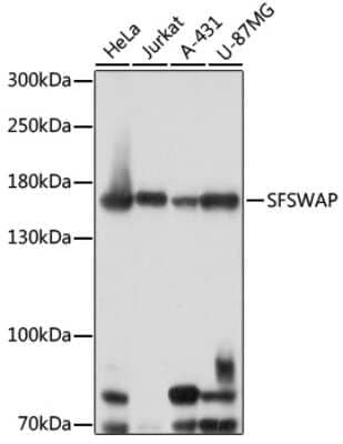 Western Blot: SFRS8 AntibodyAzide and BSA Free [NBP2-94834]