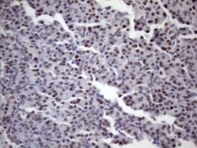 Immunohistochemistry: SFRS9 Antibody (OTI5G7) [NBP2-45429]