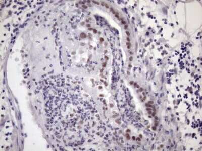 Immunohistochemistry: SFRS9 Antibody (OTI5G7) [NBP2-45429]
