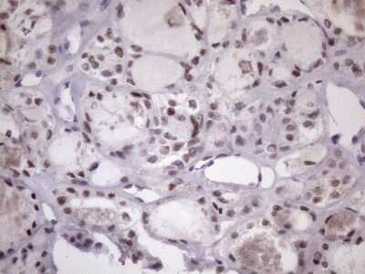 Immunohistochemistry: SFRS9 Antibody (OTI5G7) [NBP2-45429]