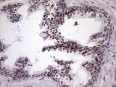 Immunohistochemistry: SFRS9 Antibody (OTI5G7) [NBP2-45429]