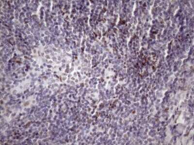 Immunohistochemistry: SFRS9 Antibody (OTI5G7) [NBP2-45429]