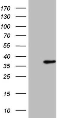 Western Blot: SFRS9 Antibody (OTI5G7) [NBP2-45429]